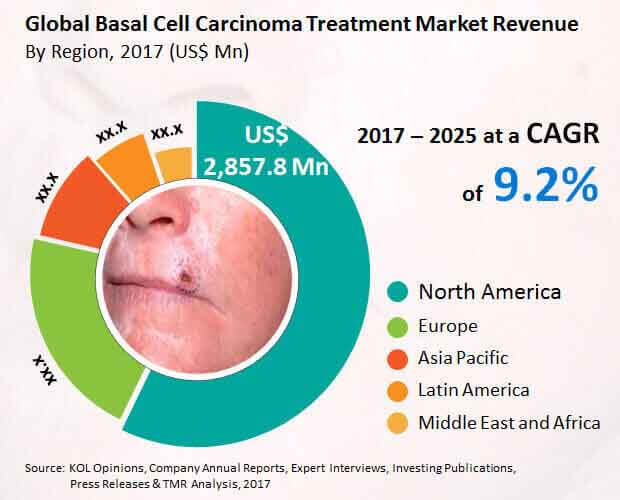 basal cell carcinoma treatment market
