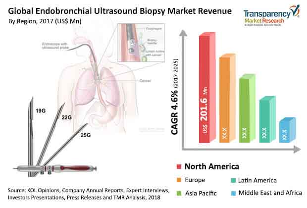 global endobronchial ultrasound biopsy market