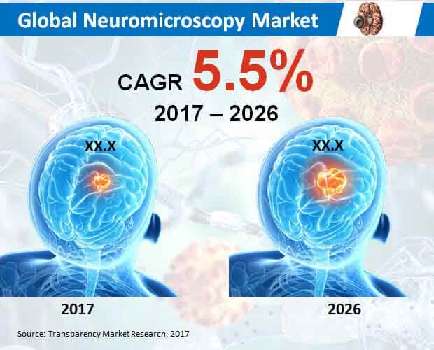 global-neuromicroscopy-market.jpg