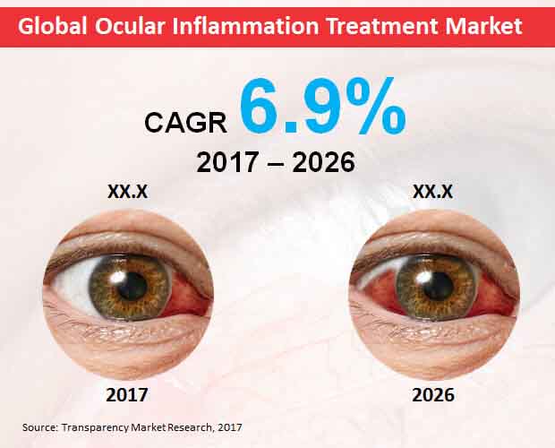 Global Ocular Inflammation Treatment Market global ocular inflammation treatment market