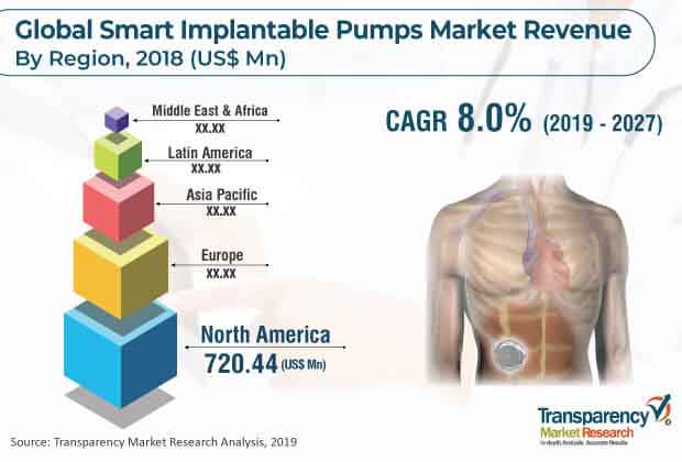 global smart implantable pumps market