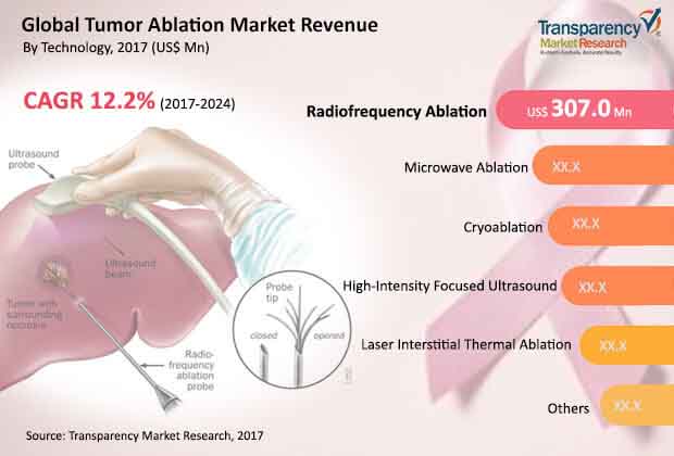 global tumor ablation market