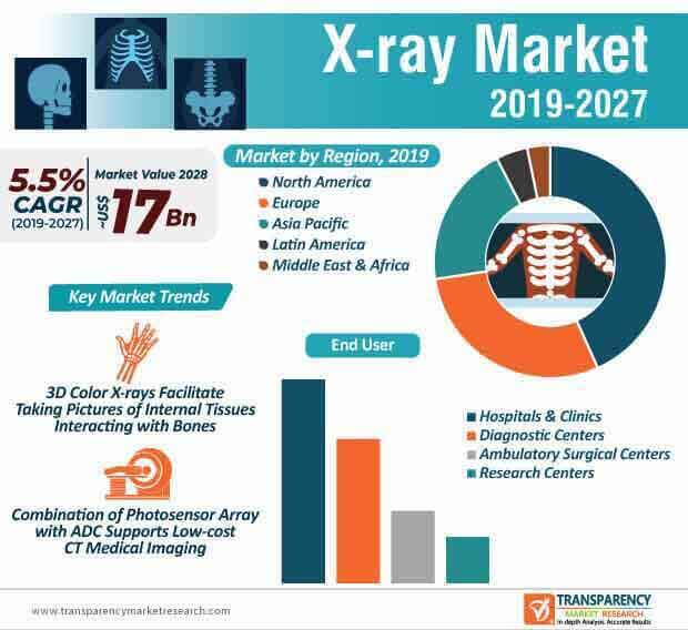 x ray market infographic