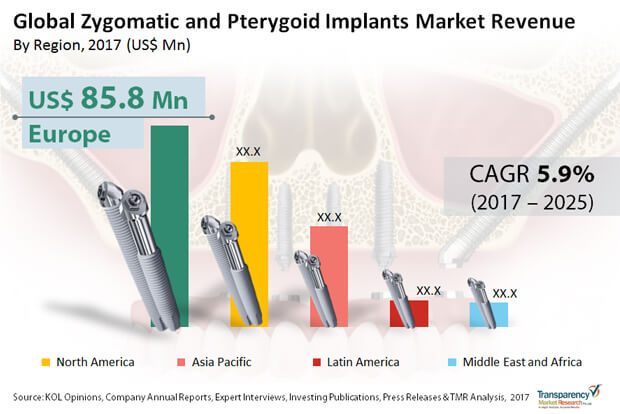 zygomatic-and-pterygoid-market.jpg